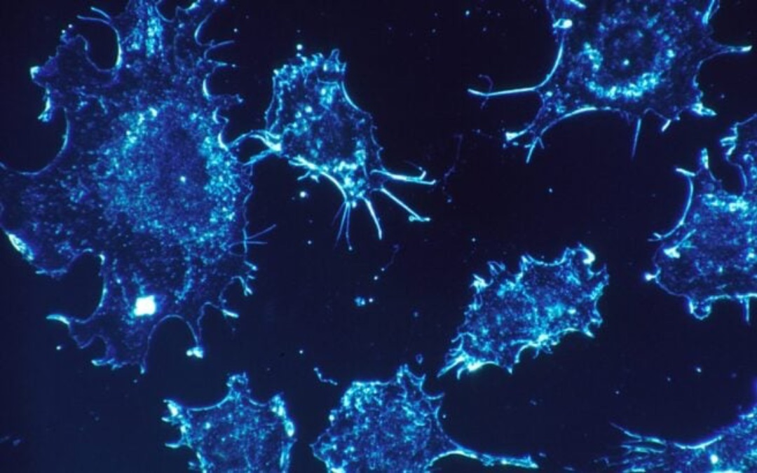 [Keynote recherche] Rémy Nicolle, Modéliser le phénotype d’une tumeur, un nouvel espoir pour l’oncologie de précision