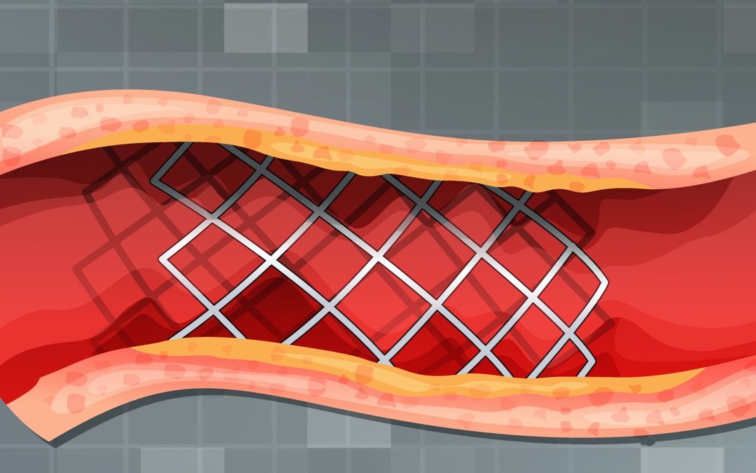 [Keynote recherche] Giuseppina Caligiuri, Le paradoxe du dispositif endovasculaire : comment transformer un sauveur rejeté en allié accepté ?