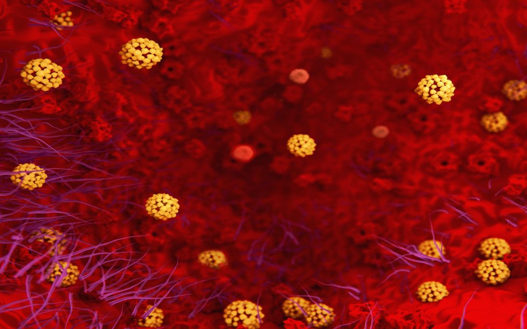 Une nouvelle piste possible pour expliquer les cas graves de la Covid-19