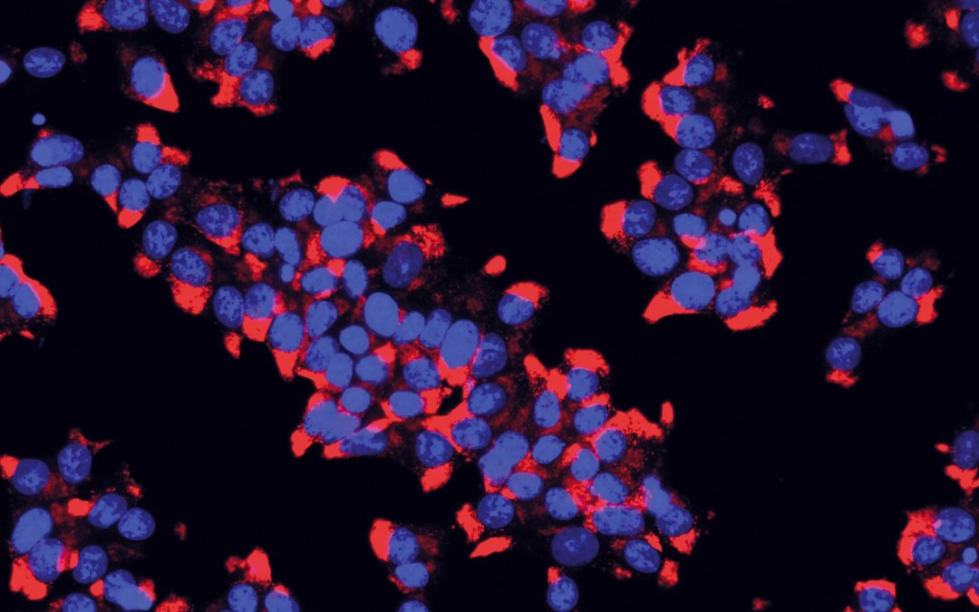 Diabète de type 2 : découverte d’un nouveau marqueur biologique de risque cardiovasculaire