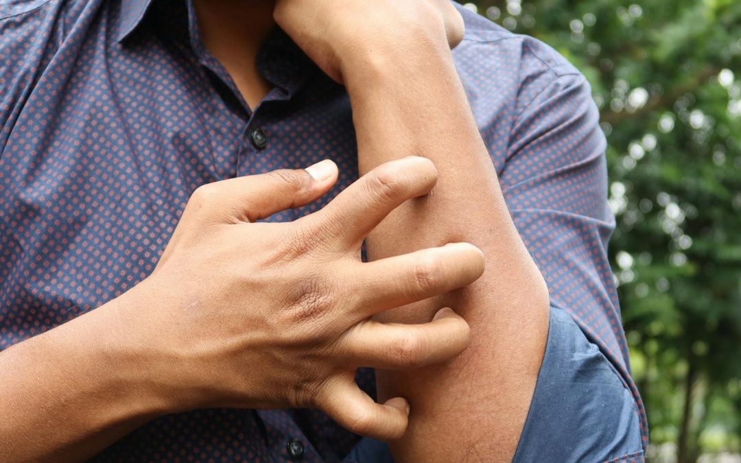 Psoriasis : une découverte génétique clé ouvre la voie au premier traitement sur mesure
